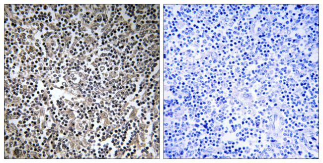 MPRIP Antibody in Immunohistochemistry (Paraffin) (IHC (P))