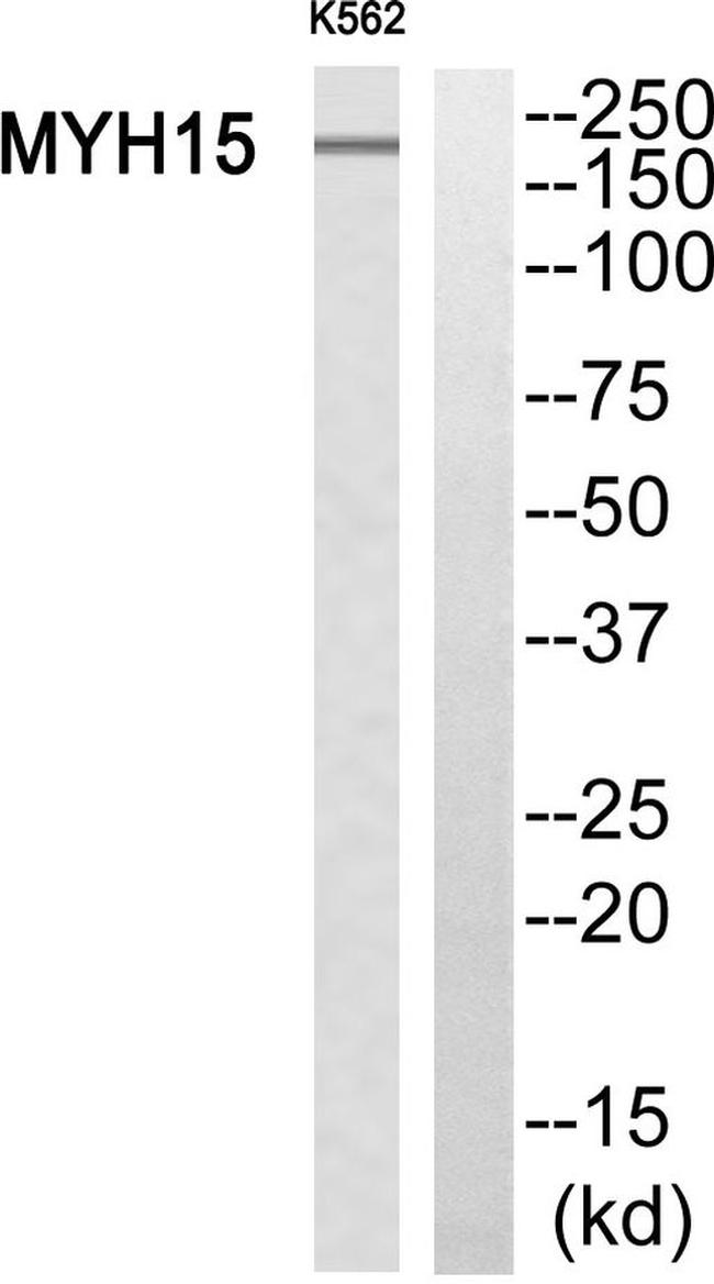 MYH15 Antibody in Western Blot (WB)