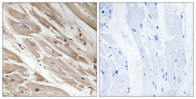 MYBPC3 Antibody in Immunohistochemistry (Paraffin) (IHC (P))