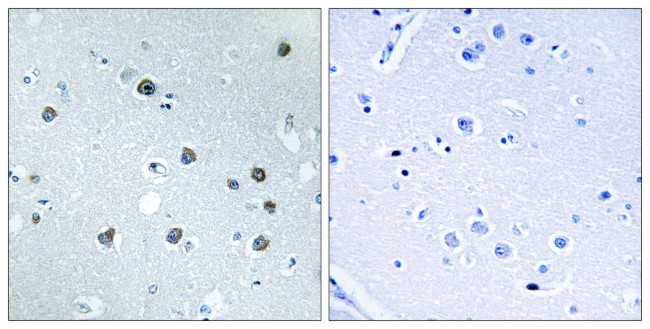 MYO1D Antibody in Immunohistochemistry (Paraffin) (IHC (P))