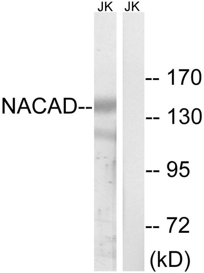 NACAD Antibody in Western Blot (WB)