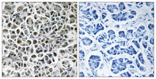 NDUFA3 Antibody in Immunohistochemistry (Paraffin) (IHC (P))
