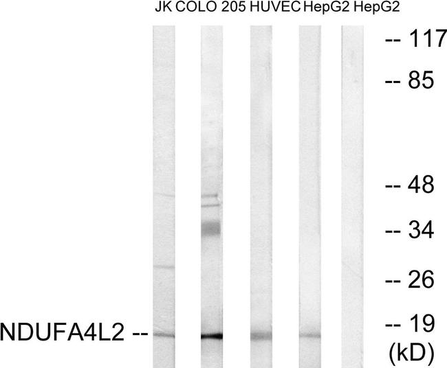 NDUFA4L2 Antibody in Western Blot (WB)