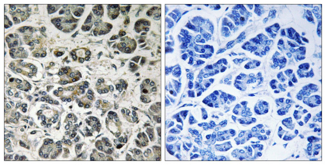 NDUFA8 Antibody in Immunohistochemistry (Paraffin) (IHC (P))