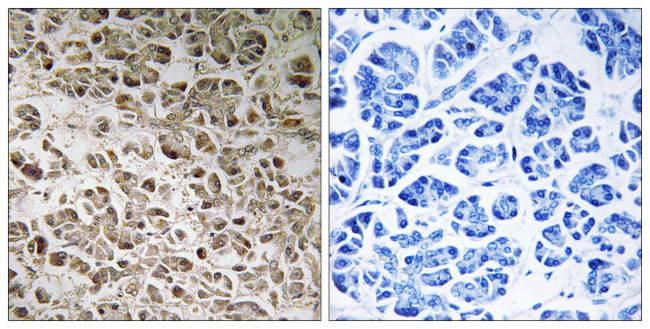 NDUFB1 Antibody in Immunohistochemistry (Paraffin) (IHC (P))