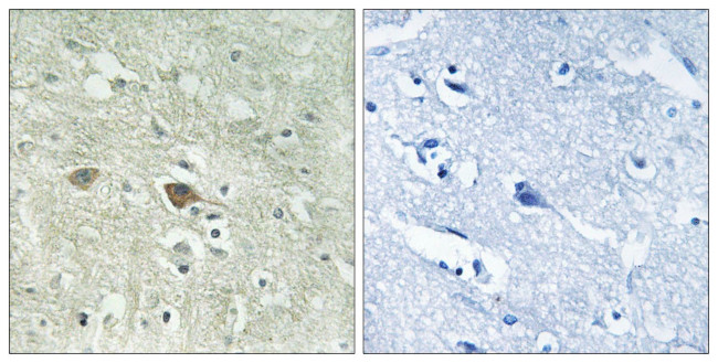NDUFV3 Antibody in Immunohistochemistry (Paraffin) (IHC (P))