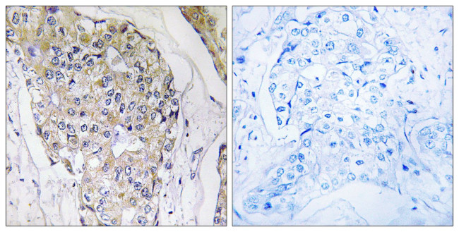 NDUFS6 Antibody in Immunohistochemistry (Paraffin) (IHC (P))