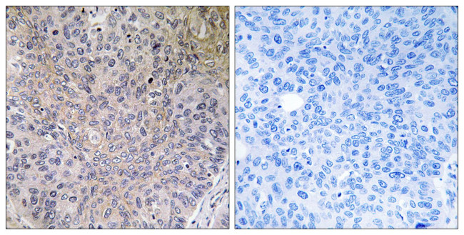 NDUFS7 Antibody in Immunohistochemistry (Paraffin) (IHC (P))