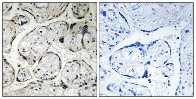 CYB5R3 Antibody in Immunohistochemistry (Paraffin) (IHC (P))