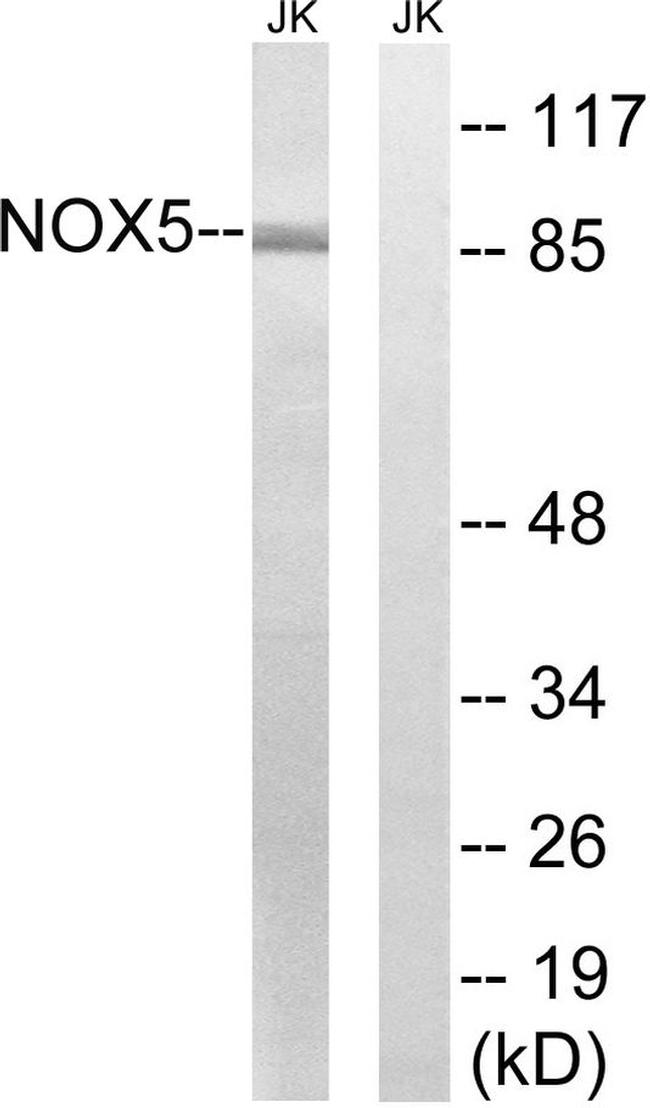 NOX5 Antibody in Western Blot (WB)