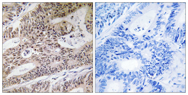 NPHP4 Antibody in Immunohistochemistry (Paraffin) (IHC (P))