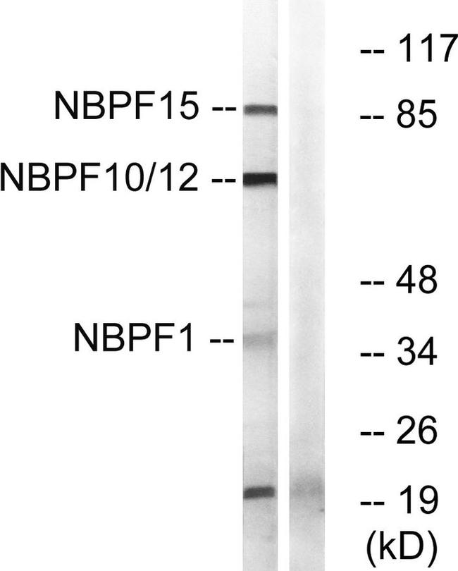 NBPF Pan Antibody in Western Blot (WB)
