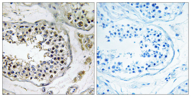 NBPF4 Antibody in Immunohistochemistry (Paraffin) (IHC (P))