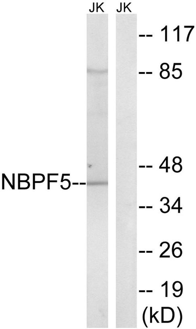 NBPF5P Antibody in Western Blot (WB)