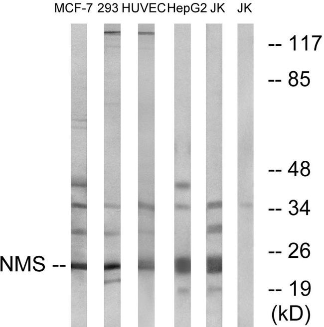 NMS Antibody in Western Blot (WB)