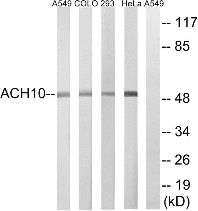 CHRNA10 Antibody in Western Blot (WB)
