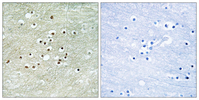 NPAS4 Antibody in Immunohistochemistry (Paraffin) (IHC (P))