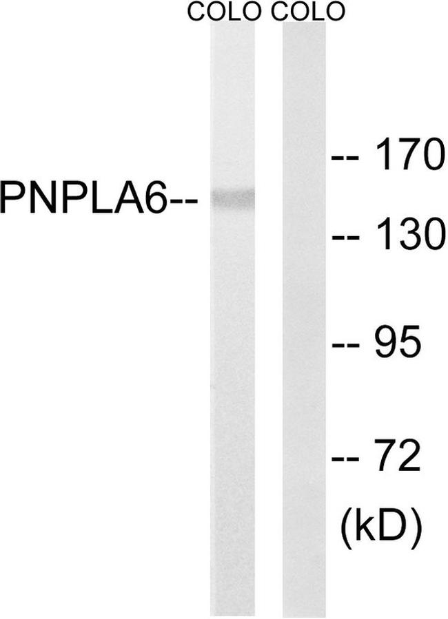 NTE Antibody in Western Blot (WB)