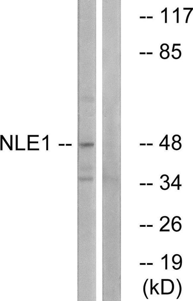 NLE1 Antibody in Western Blot (WB)
