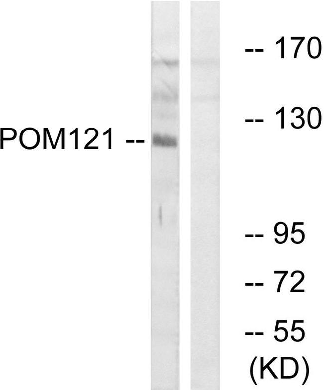 POM121 Antibody in Western Blot (WB)