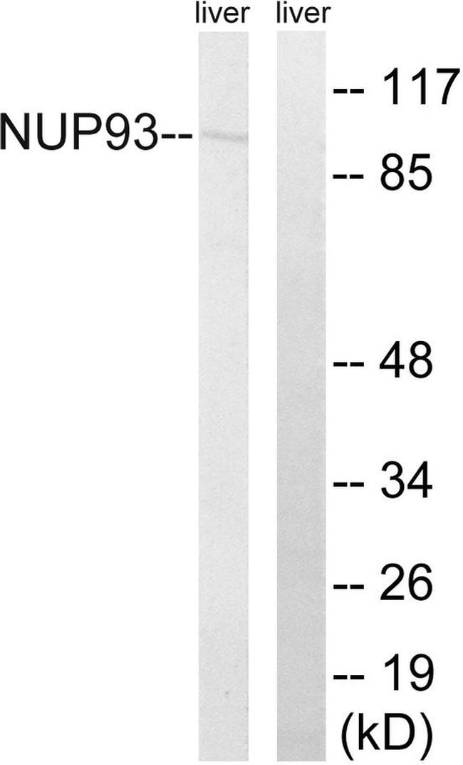 NUP93 Antibody in Western Blot (WB)
