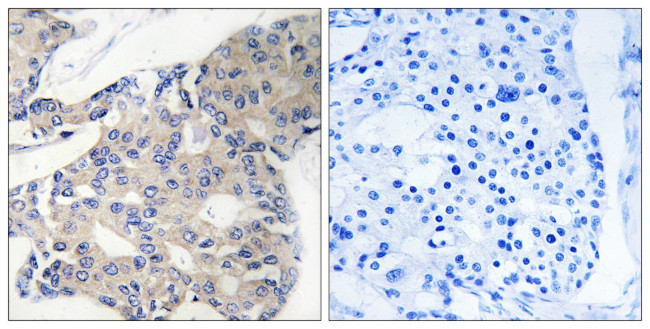 NCOA4 Antibody in Immunohistochemistry (Paraffin) (IHC (P))