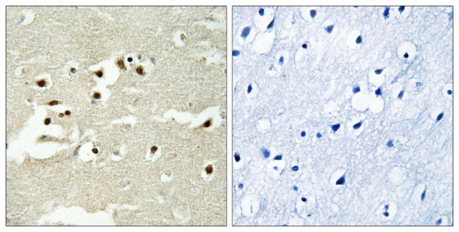 NCOA5 Antibody in Immunohistochemistry (Paraffin) (IHC (P))