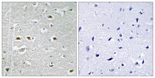 URB1 Antibody in Immunohistochemistry (Paraffin) (IHC (P))