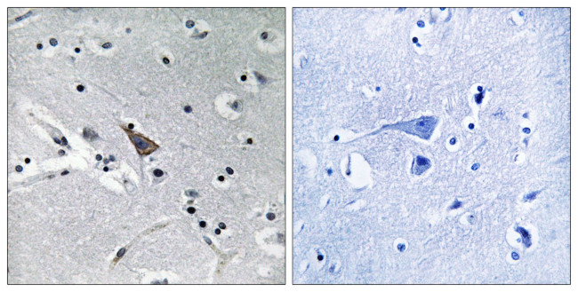 SLC6A16 Antibody in Immunohistochemistry (Paraffin) (IHC (P))