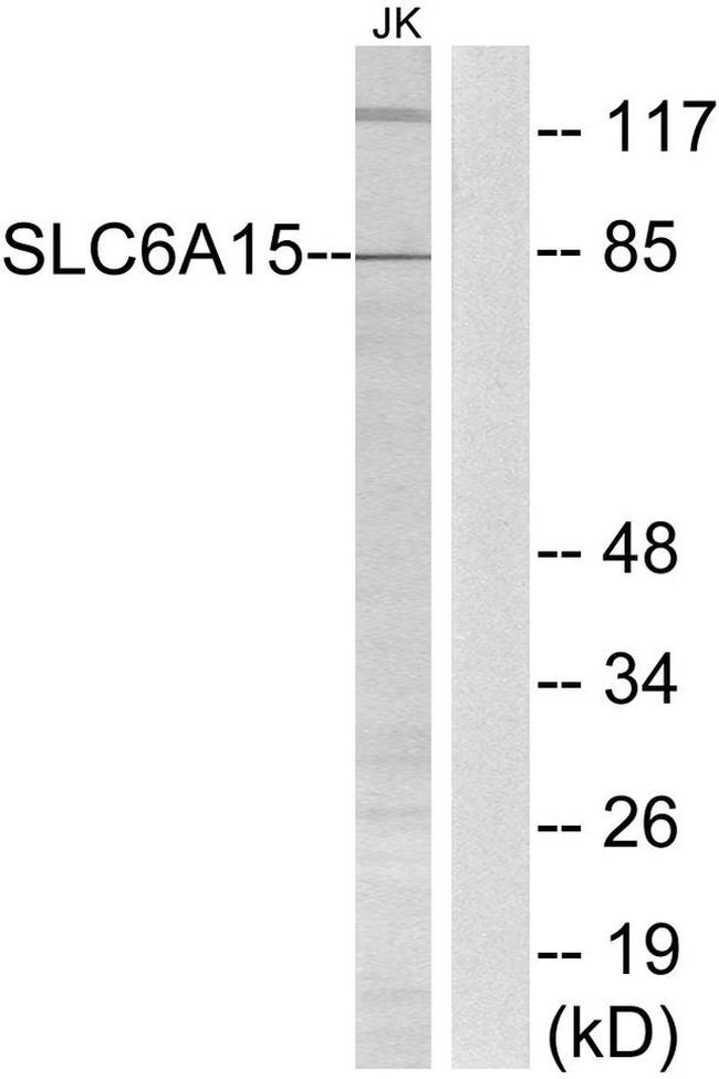 SLC6A15 Antibody in Western Blot (WB)