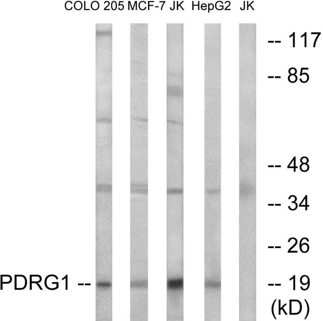 PDRG1 Antibody in Western Blot (WB)