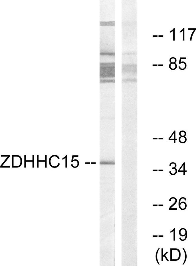ZDHHC15 Antibody in Western Blot (WB)