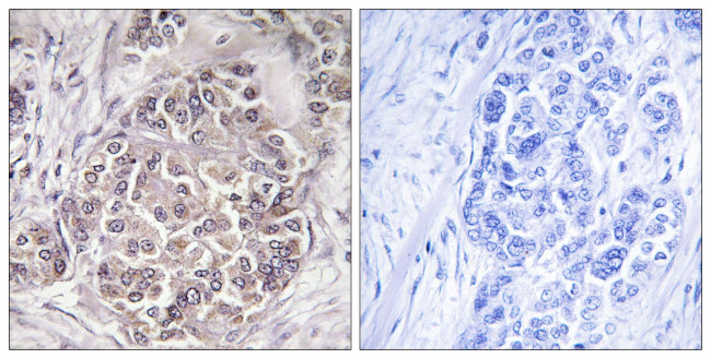 PEX1 Antibody in Immunohistochemistry (Paraffin) (IHC (P))