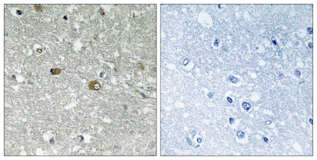 PIGH Antibody in Immunohistochemistry (Paraffin) (IHC (P))
