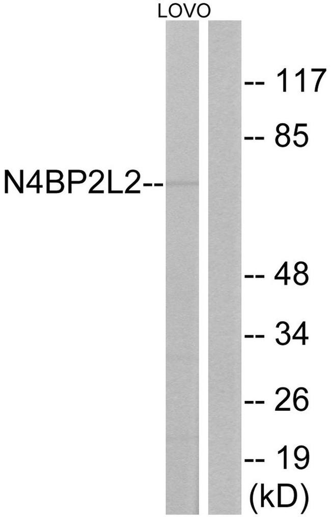 N4BP2L2 Antibody in Western Blot (WB)
