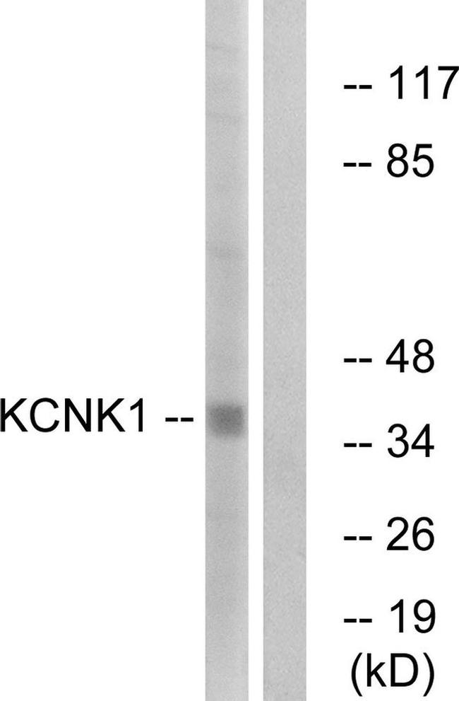 KCNK1 Antibody in Western Blot (WB)
