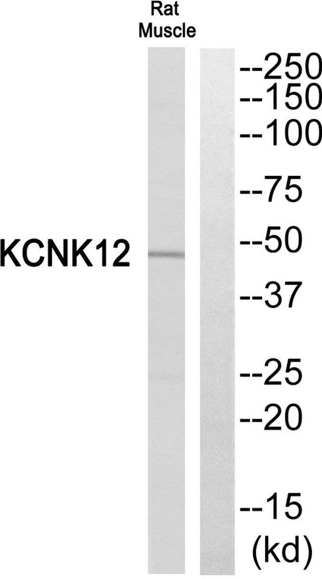 KCNK12 Antibody in Western Blot (WB)
