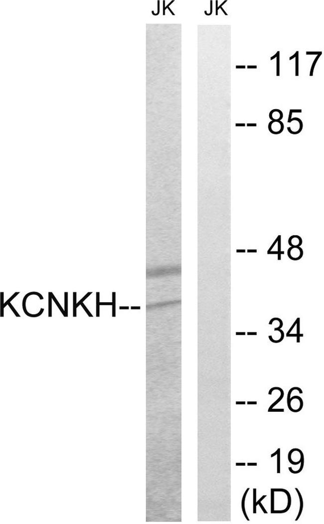 KCNK17 Antibody in Western Blot (WB)