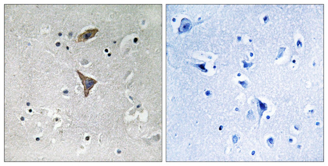KCNT1 Antibody in Immunohistochemistry (Paraffin) (IHC (P))