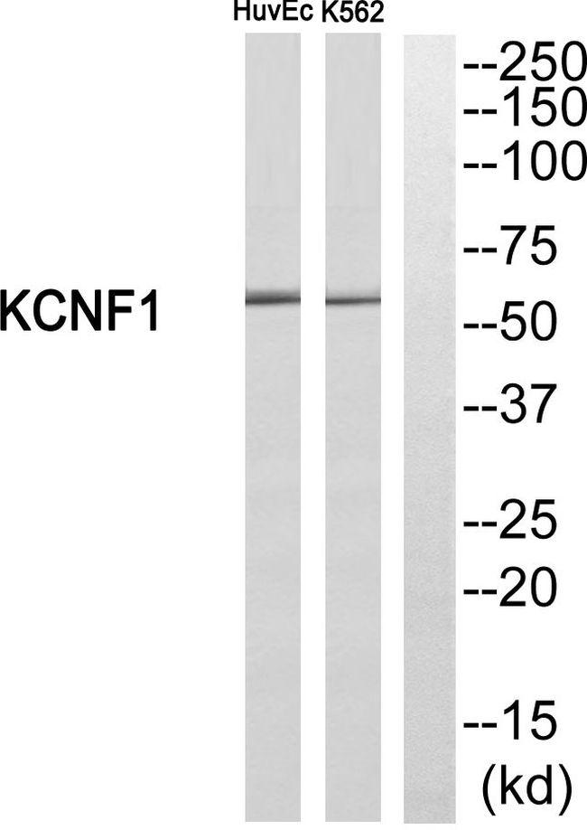 KCNF1 Antibody in Western Blot (WB)