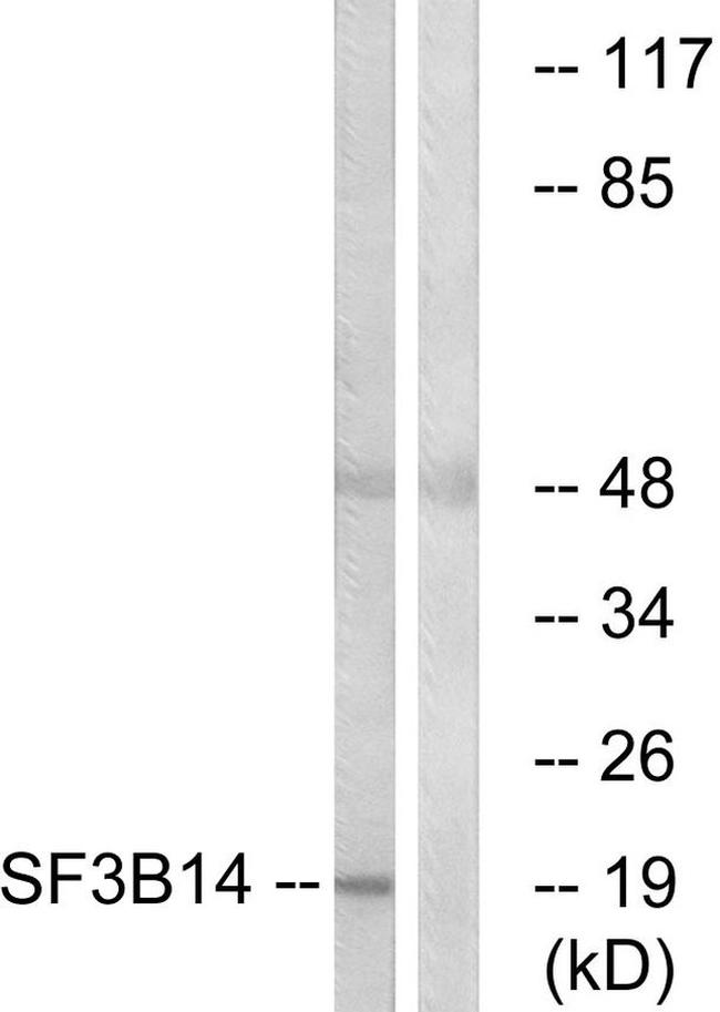 SF3B14 Antibody in Western Blot (WB)