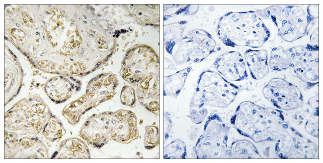 APOBEC3D/APOBEC3F Antibody in Immunohistochemistry (Paraffin) (IHC (P))