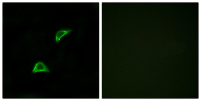 GPR158 Antibody in Immunocytochemistry (ICC/IF)
