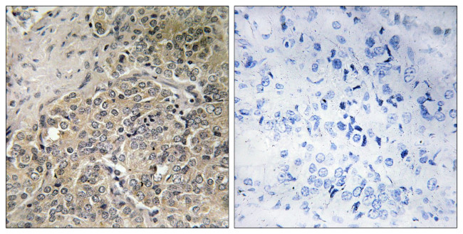 A26C2/A26C3 Antibody in Immunohistochemistry (Paraffin) (IHC (P))