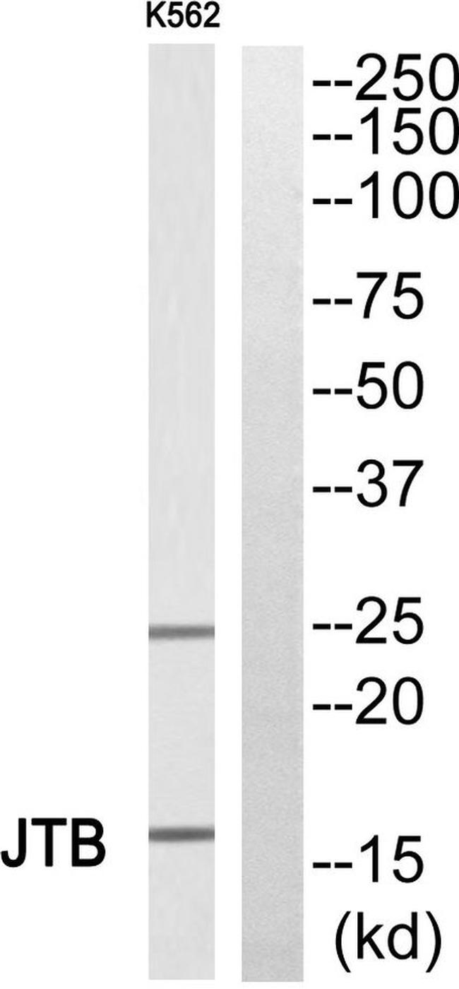 JTB Antibody in Western Blot (WB)