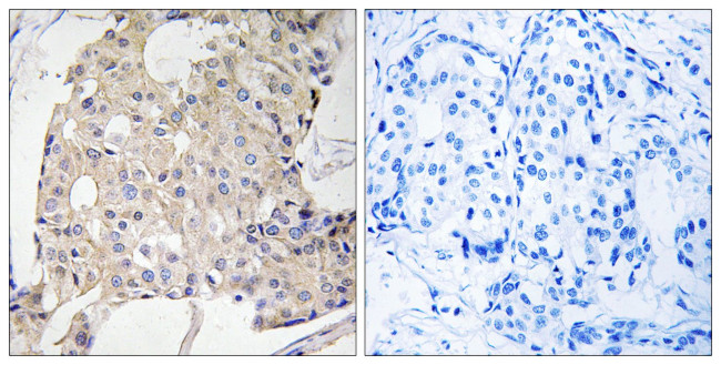 NDRG3 Antibody in Immunohistochemistry (Paraffin) (IHC (P))