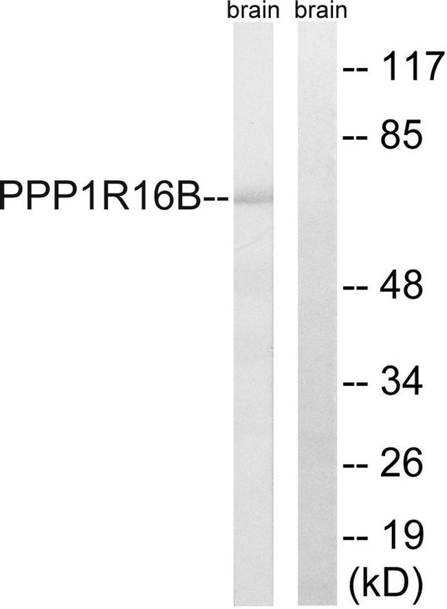 PPP1R16B Antibody in Western Blot (WB)