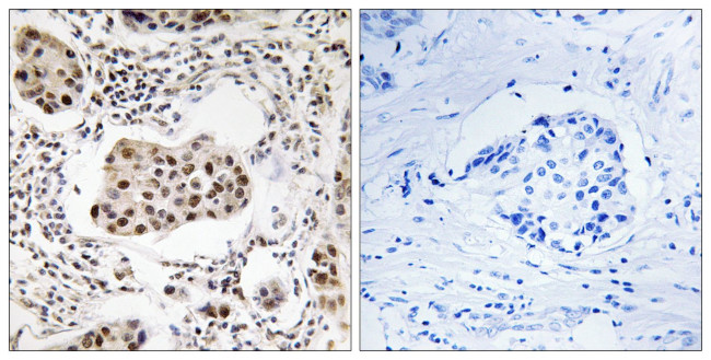 PPP1R11 Antibody in Immunohistochemistry (Paraffin) (IHC (P))