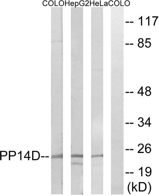 PPP1R14D Antibody in Western Blot (WB)