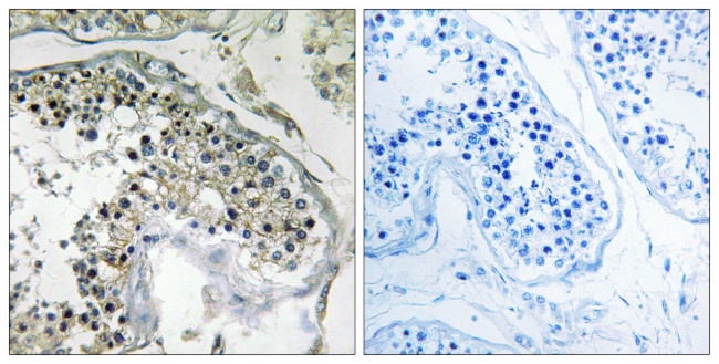 PPP1R1C Antibody in Immunohistochemistry (Paraffin) (IHC (P))